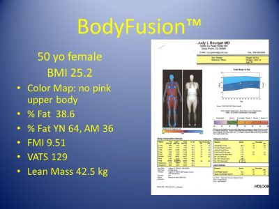 Slide20