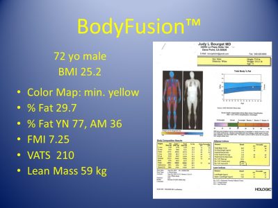 Slide21
