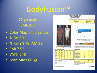 Slide22